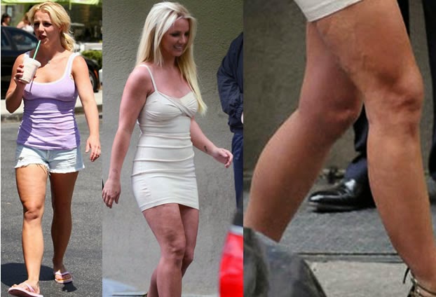 Nobody’s Perfect – Even Celebs Can’t Get Rid of Cellulite! 4 britney-spears