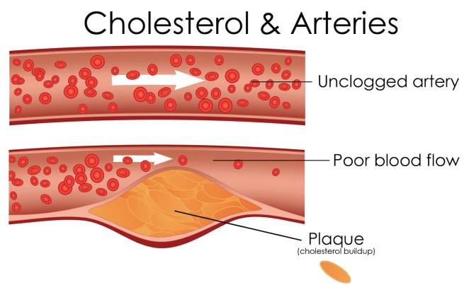 cholesterol