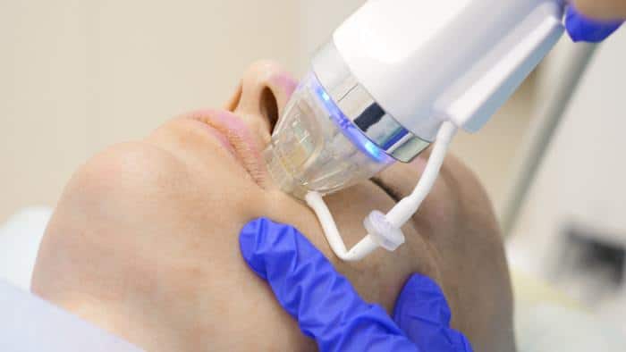 Microneedling with Radiofrequency